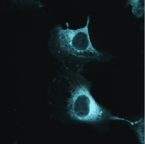 Fluorescence microscopy image identifying matrix-bound vesicles